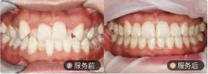 曾海莹测试案例8